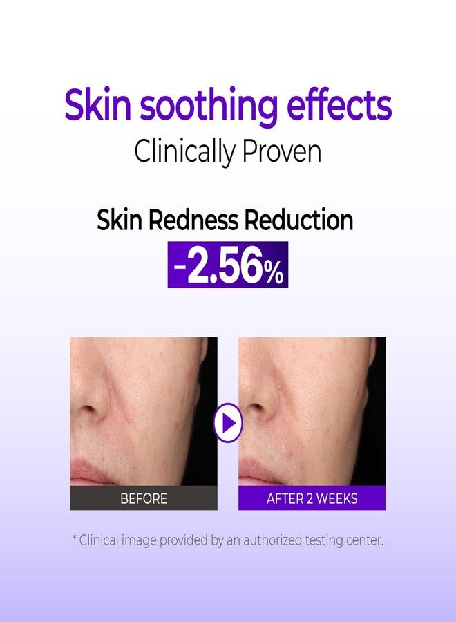 IZEZE Hyper CAA Cica Serum 1.01 Fl Oz, 30 ml | Centella Asiatica, Anti-fect, Soothing Serum for Face, Korean Skincare for Sensitive Skin, Acne Prone Skin - Image 4